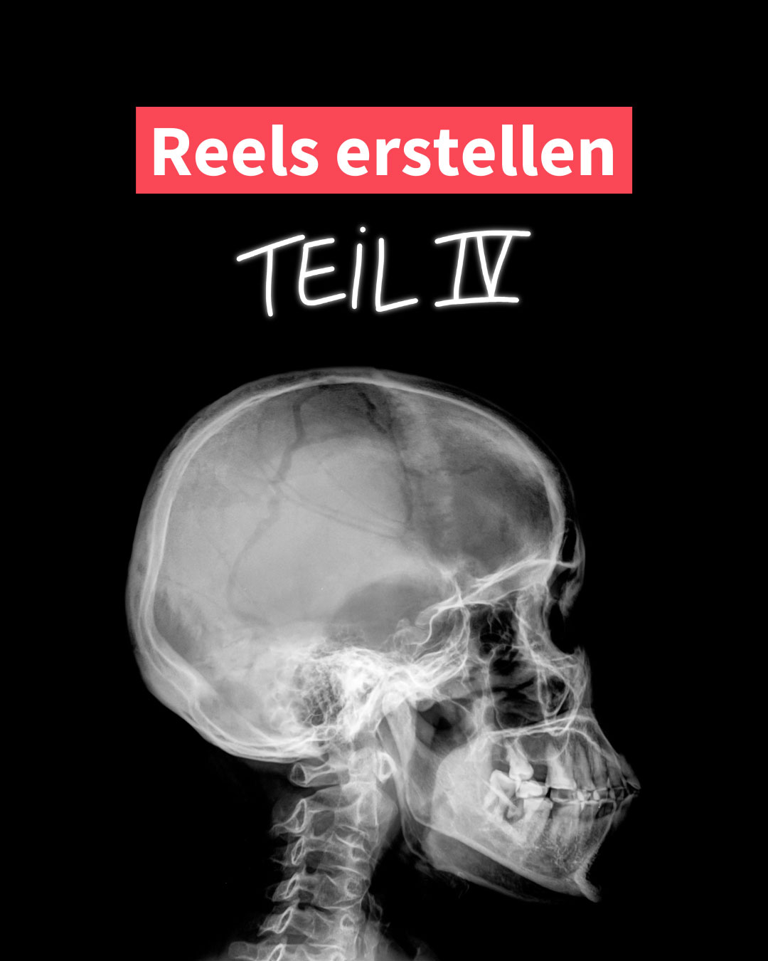 Reels erstellen